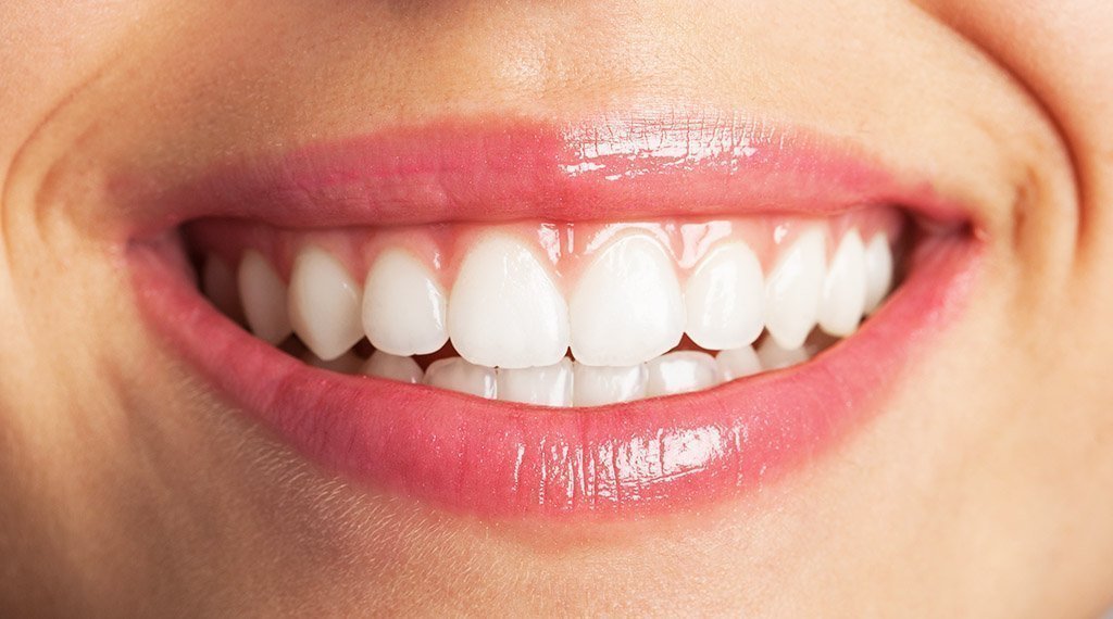 de implantes dentales patente uji