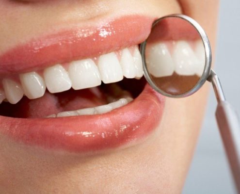 Manchas blancas dientes