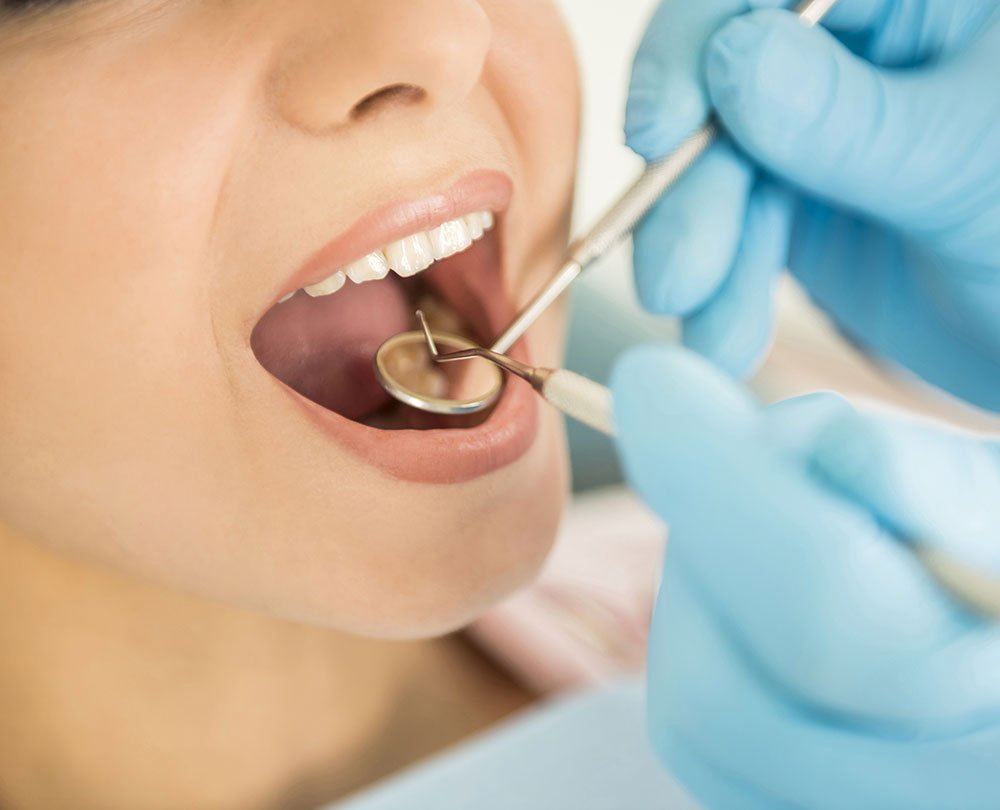 muelas del juicio clínica dental