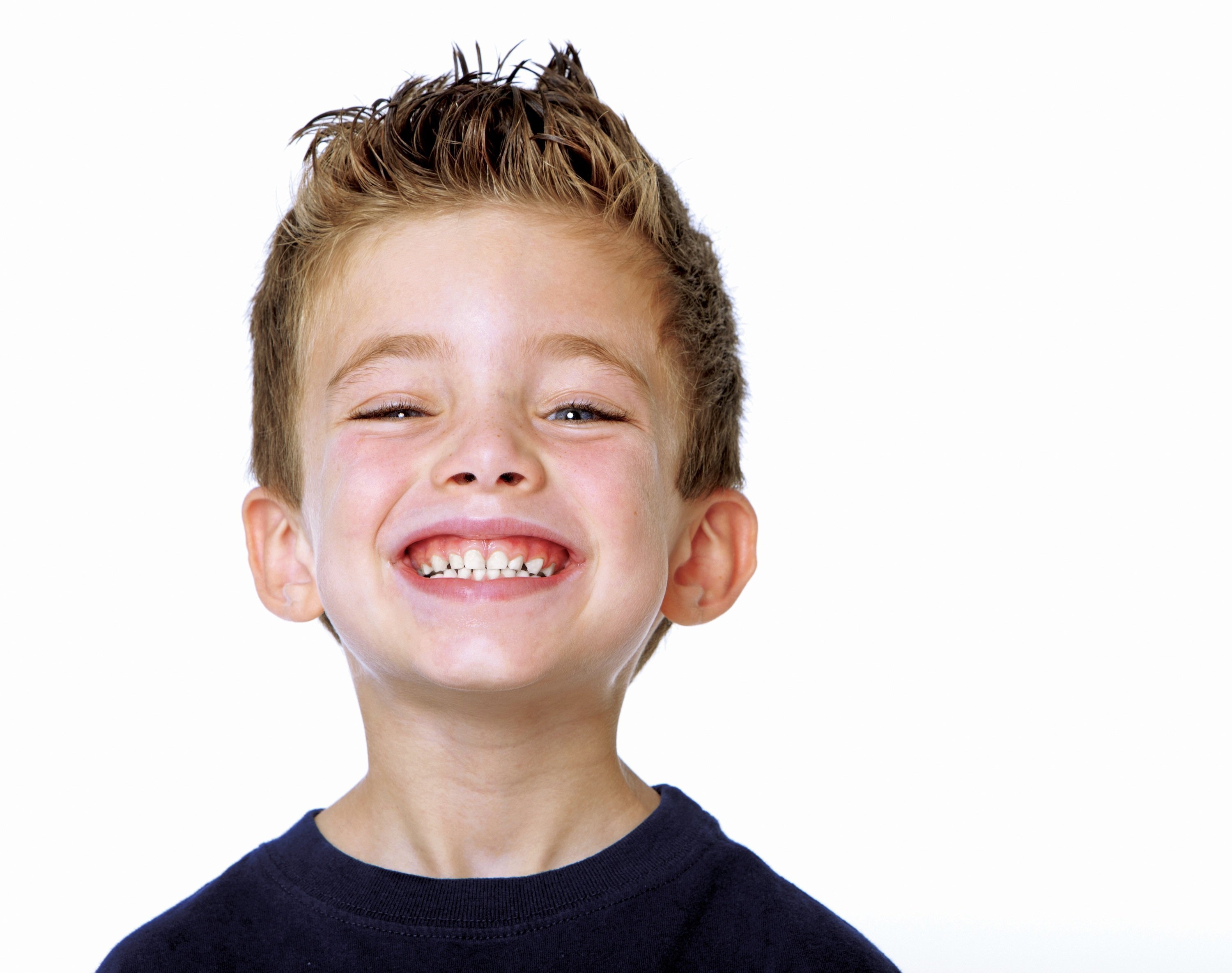 ortodoncia para niños prevenir y corregir