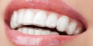 sonrisa ortodoncia invisalign